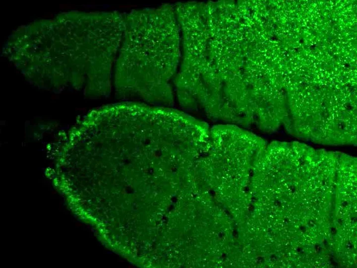Black and fluorescent green imaging showing lipid accumulation in the intestine.