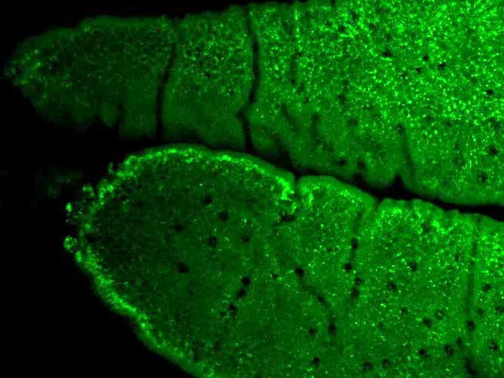 Black and fluorescent green imaging showing lipid accumulation in the intestine.